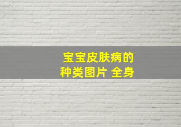 宝宝皮肤病的种类图片 全身